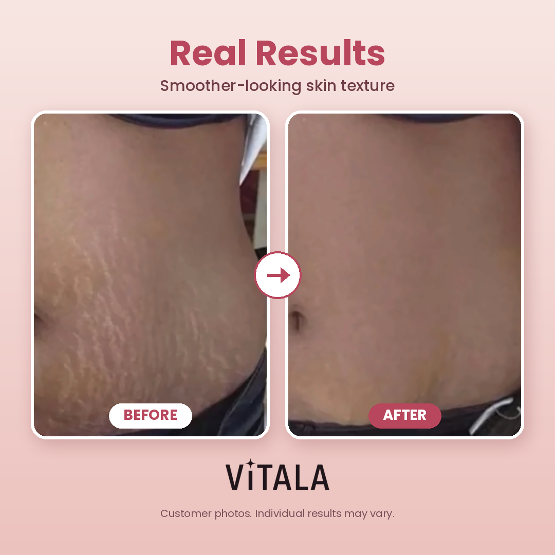 Vitala CoreGlow™
