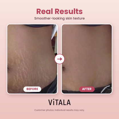 Vitala CoreGlow™